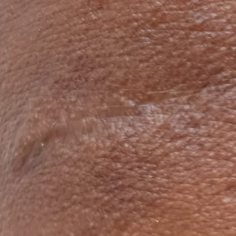 Vibha skin