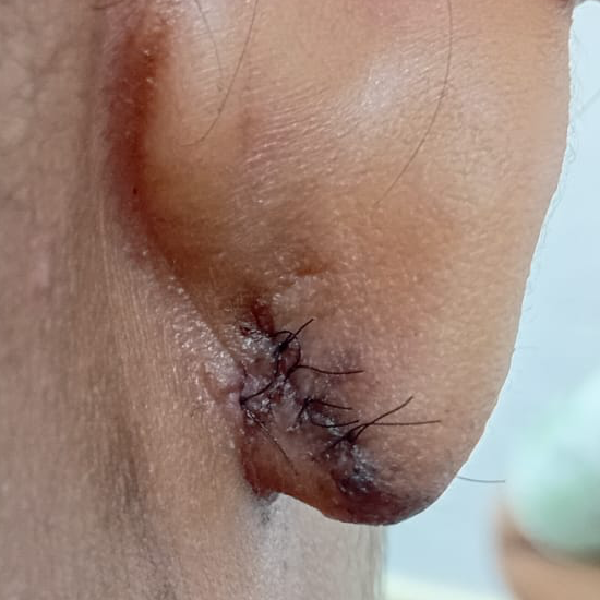 Vibha skin