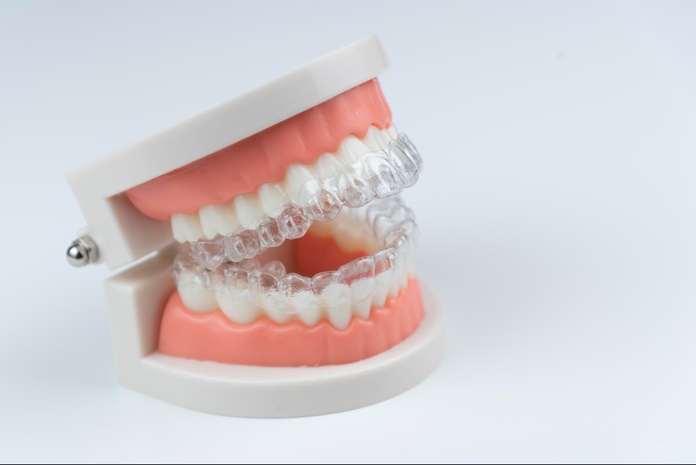 Choosing Aligners With the Right Assessment Before Starting Treatment