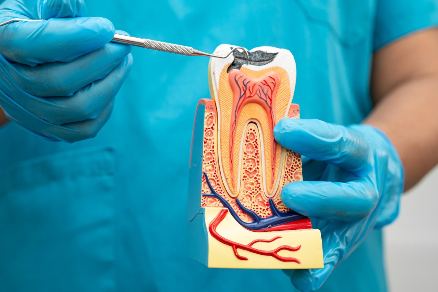 Choosing Painless Root Canal Treatment When Tooth Pain Becomes Persistent