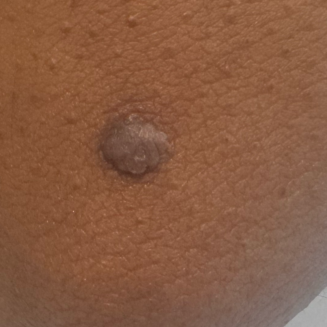 Vibha skin