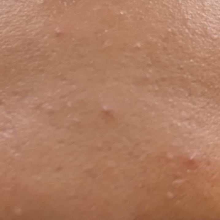 Vibha skin