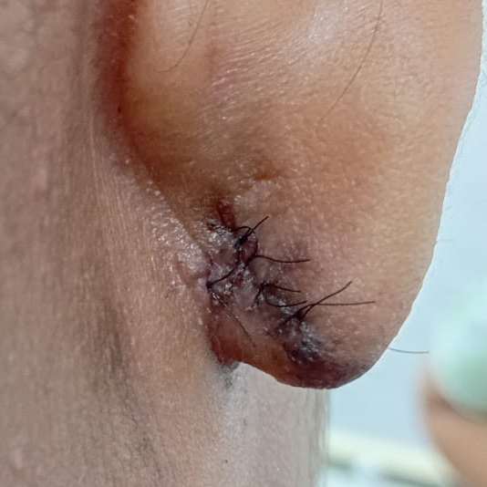 Vibha skin