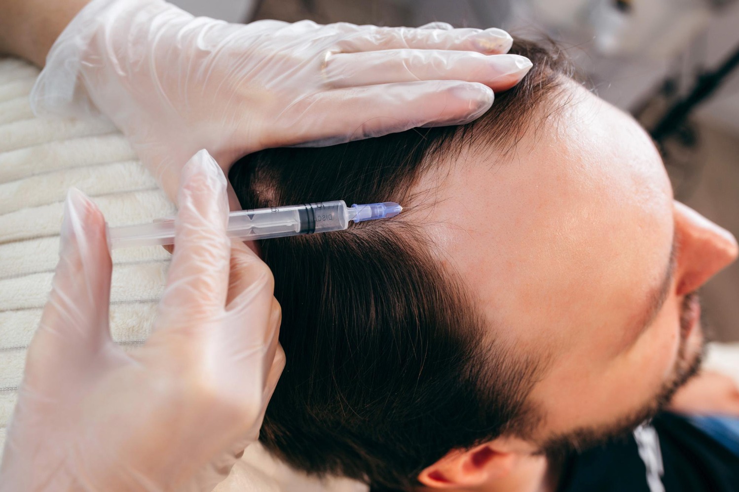 Recognising Early Signs That May Need Hair Fall Treatment Specialist Care