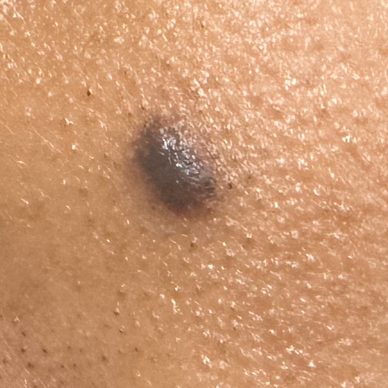 Vibha skin