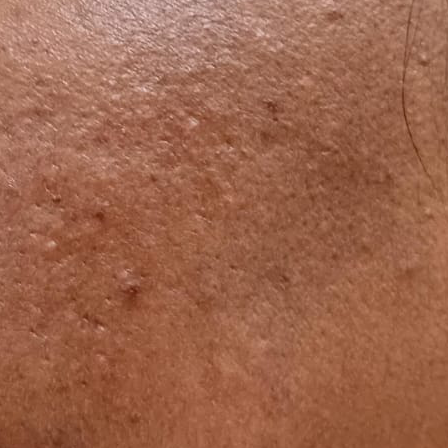Vibha skin
