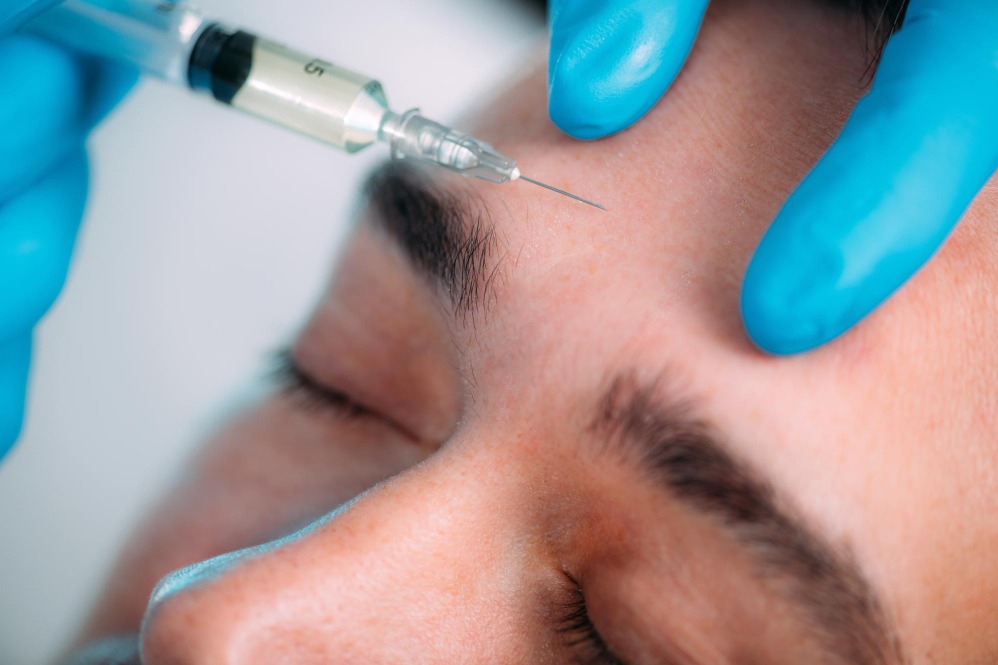 Botulinum Toxins for Expression Lines What to Know Before Treatment