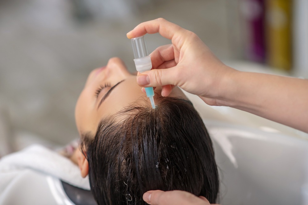 Hair Treatment in Chennai Begins With Understanding the Cause of Hair Loss