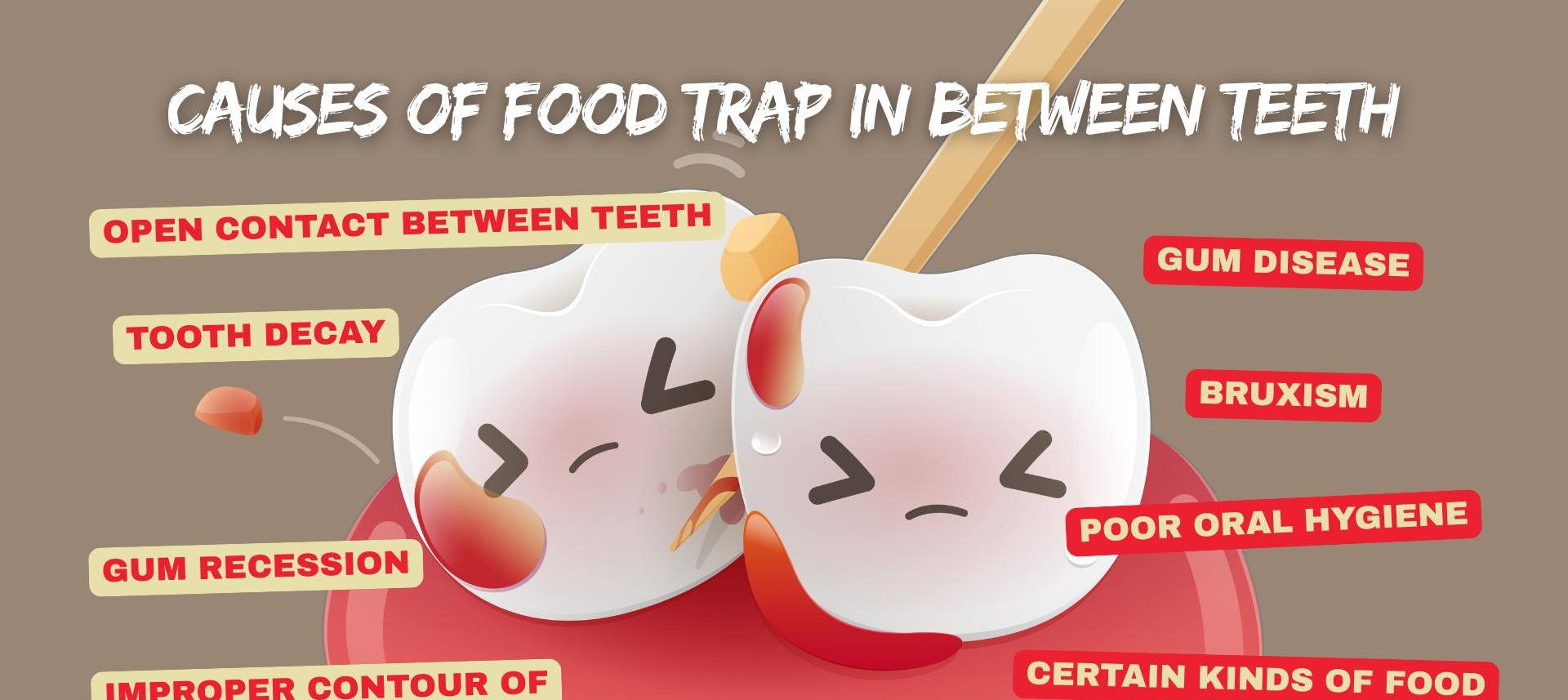 Food Getting Stuck Between Teeth: Causes and When to See a Dentist