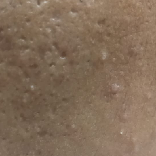 Vibha skin
