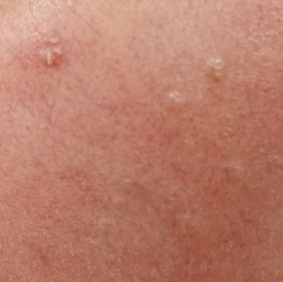 Vibha skin