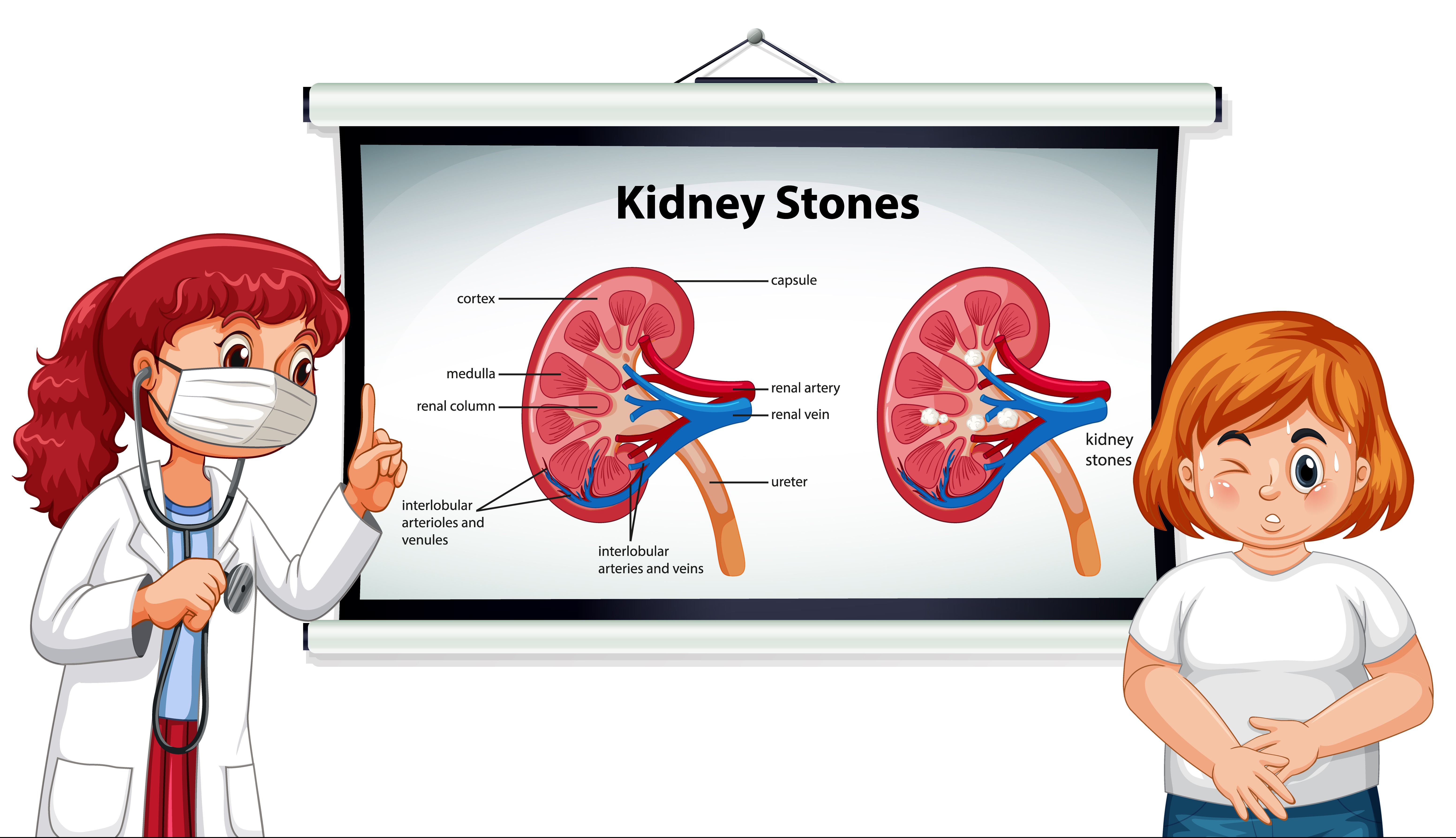 Best Kidney Stone Hospital in Jaipur
