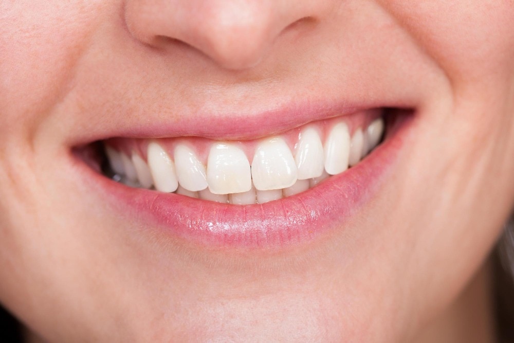 Teeth Whitening or Smile Makeover Which Is Right in Thane