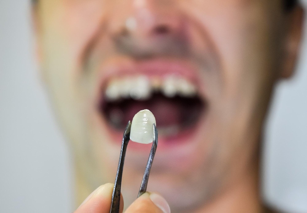 Can an Emergency Dentist Replace One Tooth in Dombivli