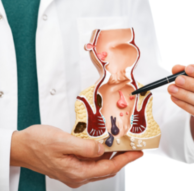Fissure Treatment Signs You May Need Specialist Evaluation in Thane