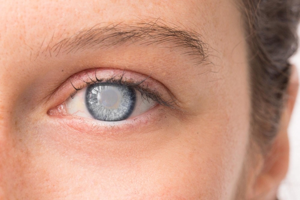 Is Cataract Care Worth Considering at Mumbai Central