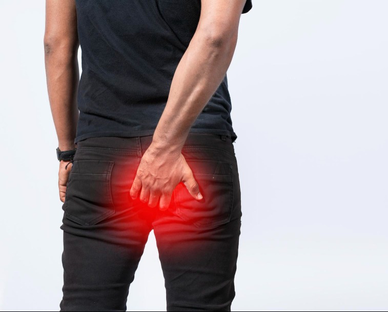 Common Mistakes People Make Before Consulting an Anal Pain Doctor