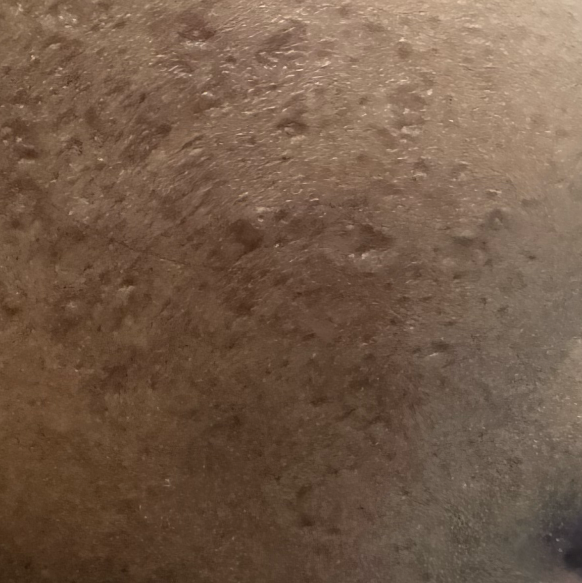 Vibha skin