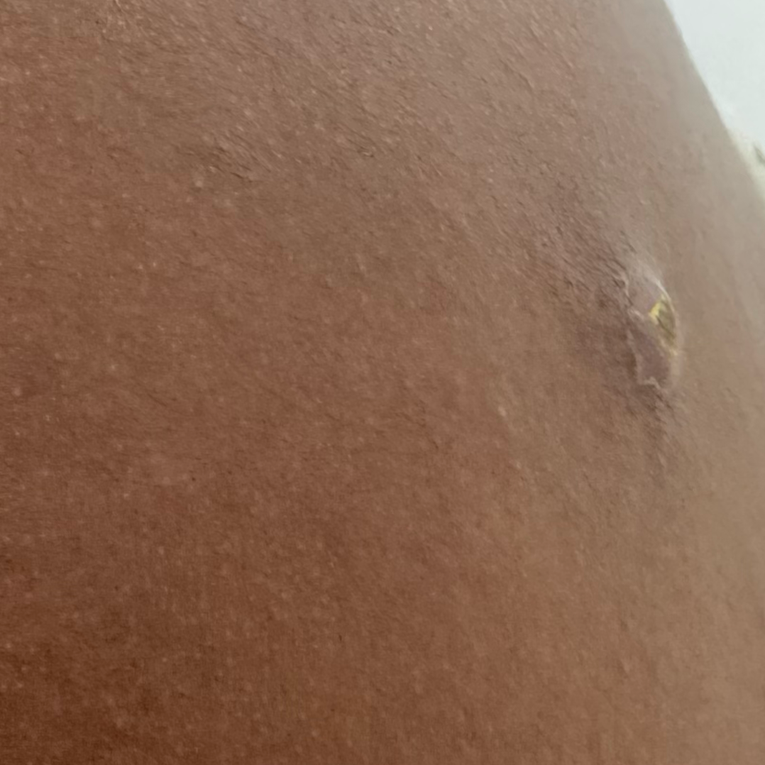 Vibha skin