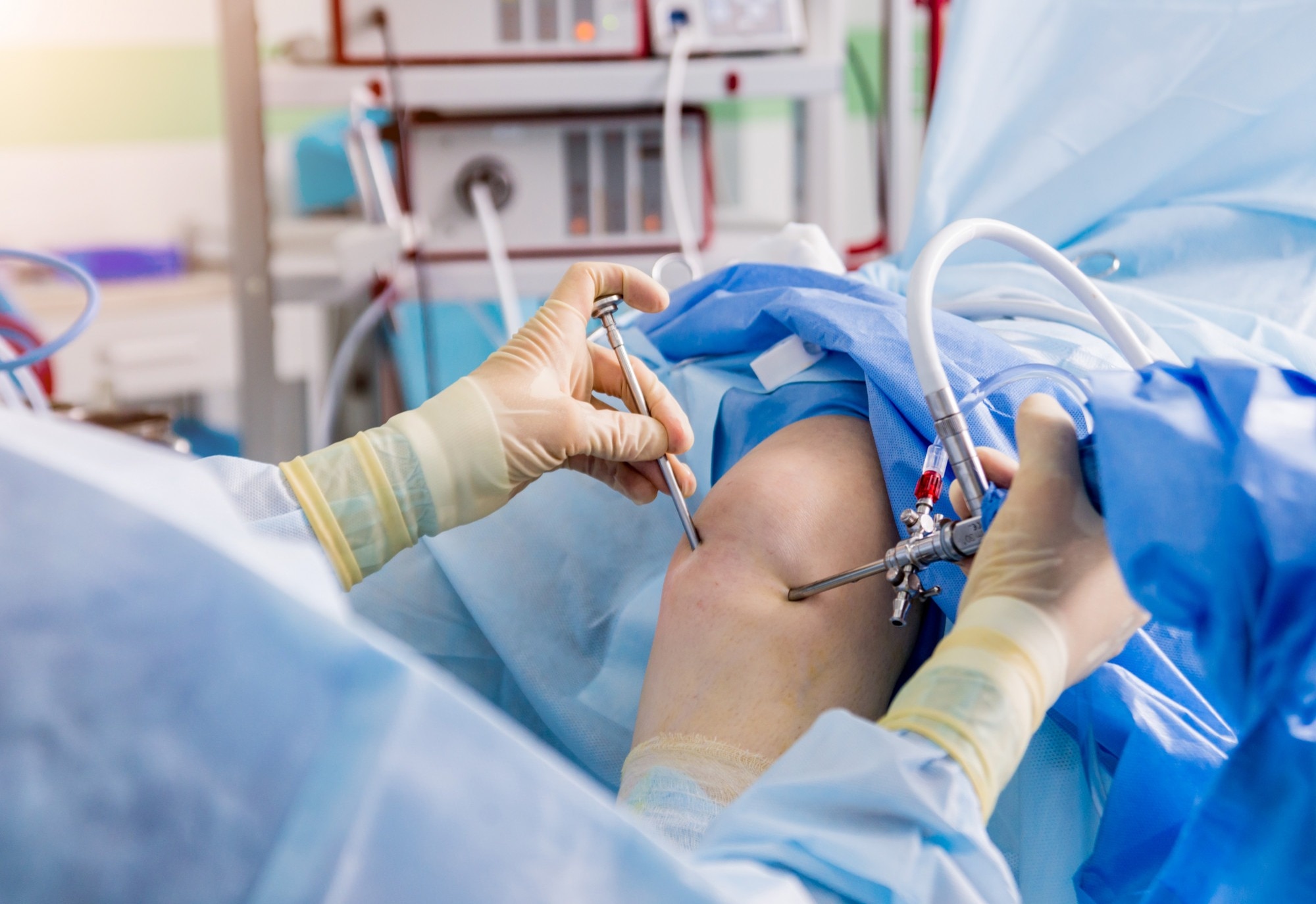 Best Orthopedics in Thane What Happens During Arthroscopy Surgery