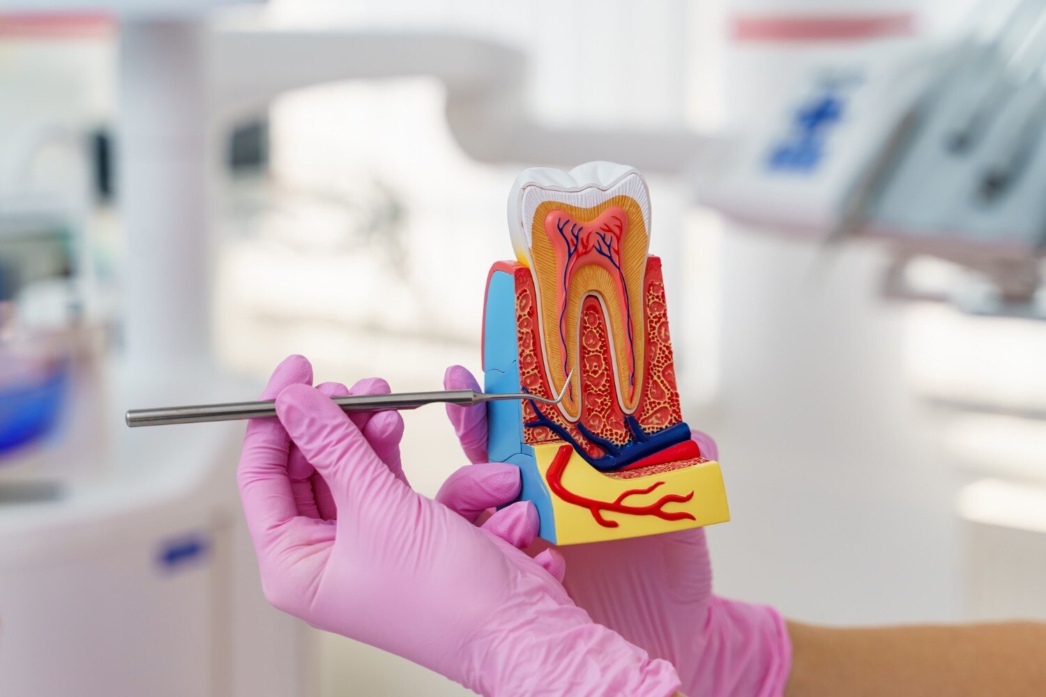 Advance Root Canal Treatment Benefits and Costs in Pune