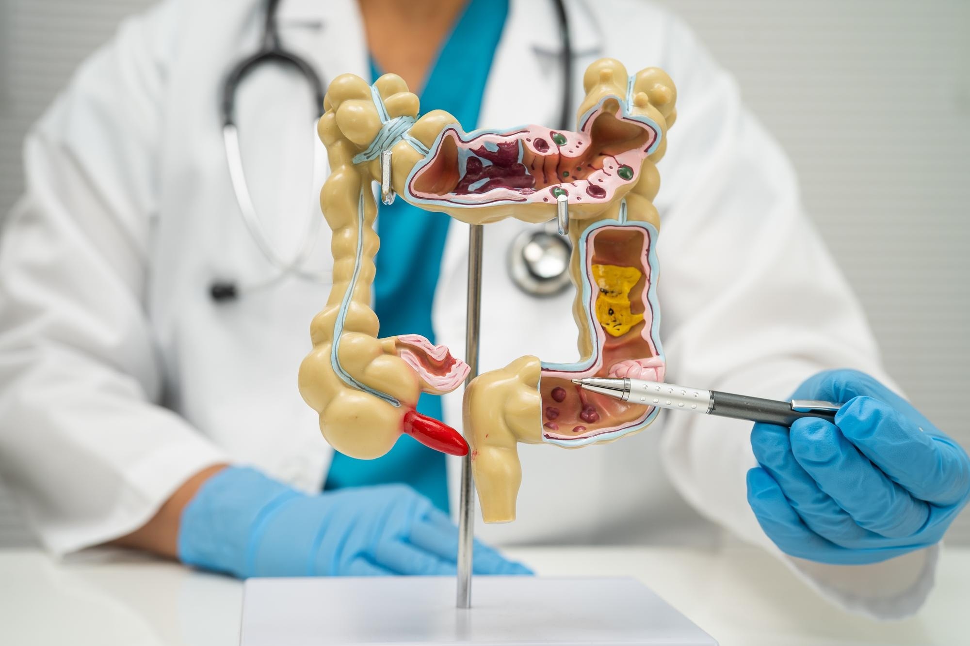 How to Book a Colorectal Surgeon in Thane for Anorectal Surgery