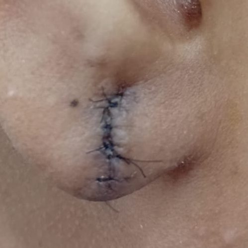 Vibha skin
