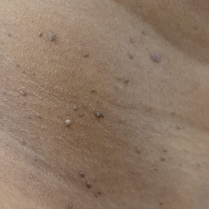 Vibha skin
