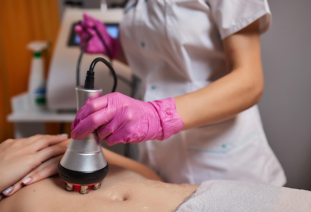 RF Skin Tightening Forma Is It Suitable for Early Facial Laxity?