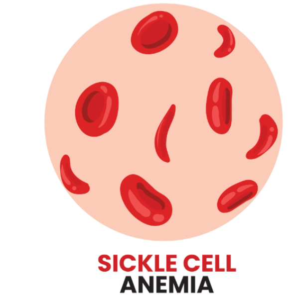 Choosing a Sickle Cell Anemia Doctor in Nagpur for Long-Term Pediatric Care
