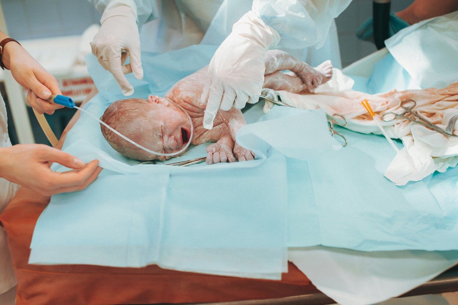 When Is a Cesarean Section Right for High Risk Pregnancy