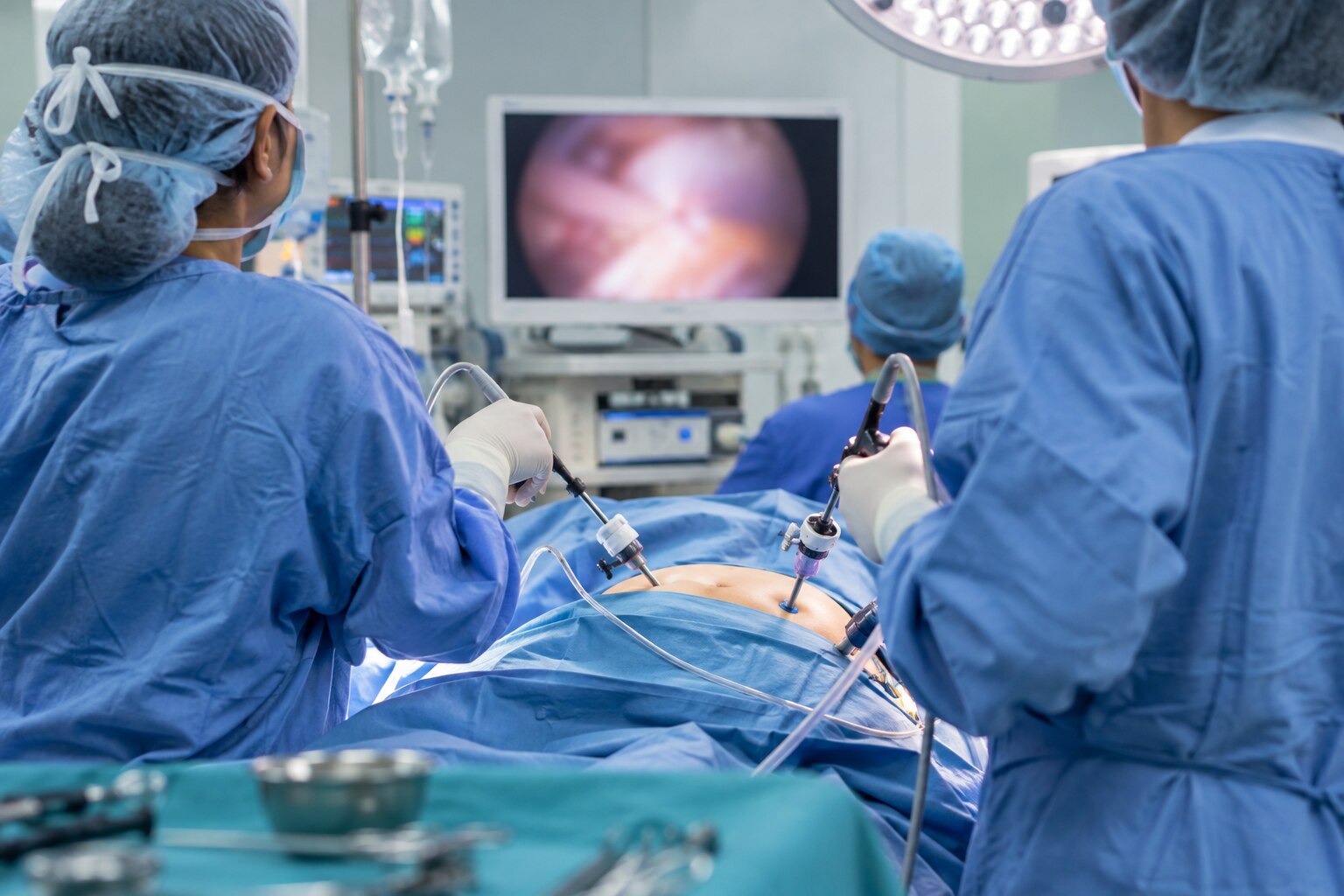 What Happens During Uterus Removal Surgery in Thane
