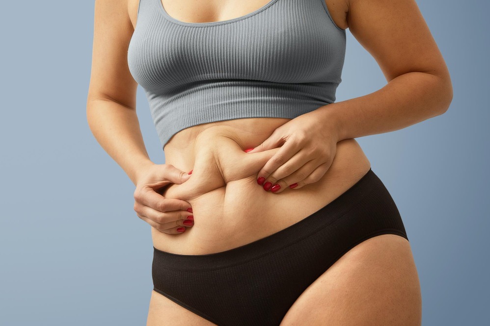 Liposuction or Weight Loss: Understanding What Each Can Realistically Achieve