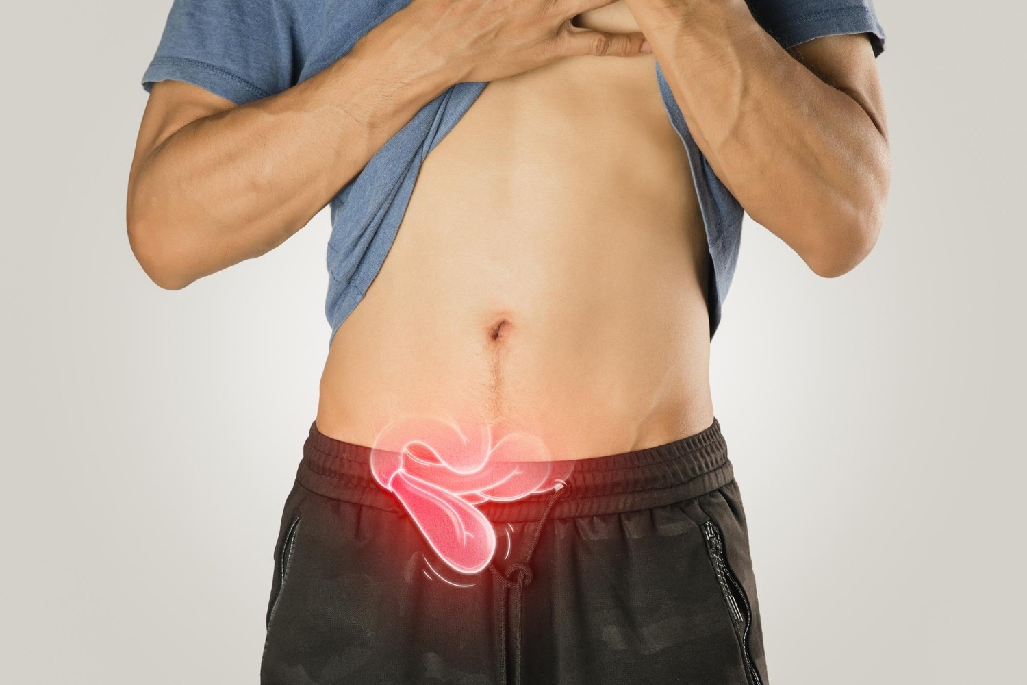 Is a Laparoscopic Surgeon Right for Hernia Repair