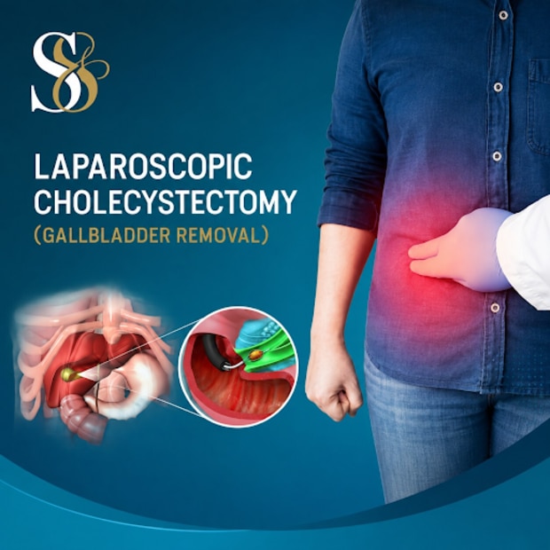 Choosing a Laparoscopic Surgeon for Gall Bladder Stone Surgery
