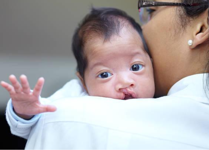 Pediatric Craniofacial Surgery for Birth Defects in Pallavaram How Parents Can Choose Care