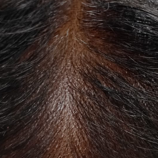 Vibha skin