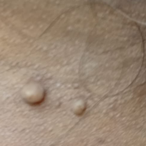 Vibha skin