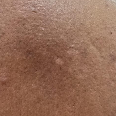 Vibha skin
