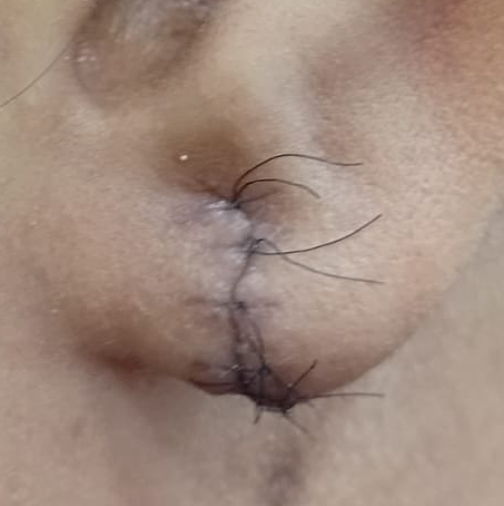 Vibha skin