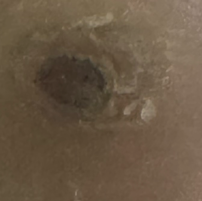 Vibha skin
