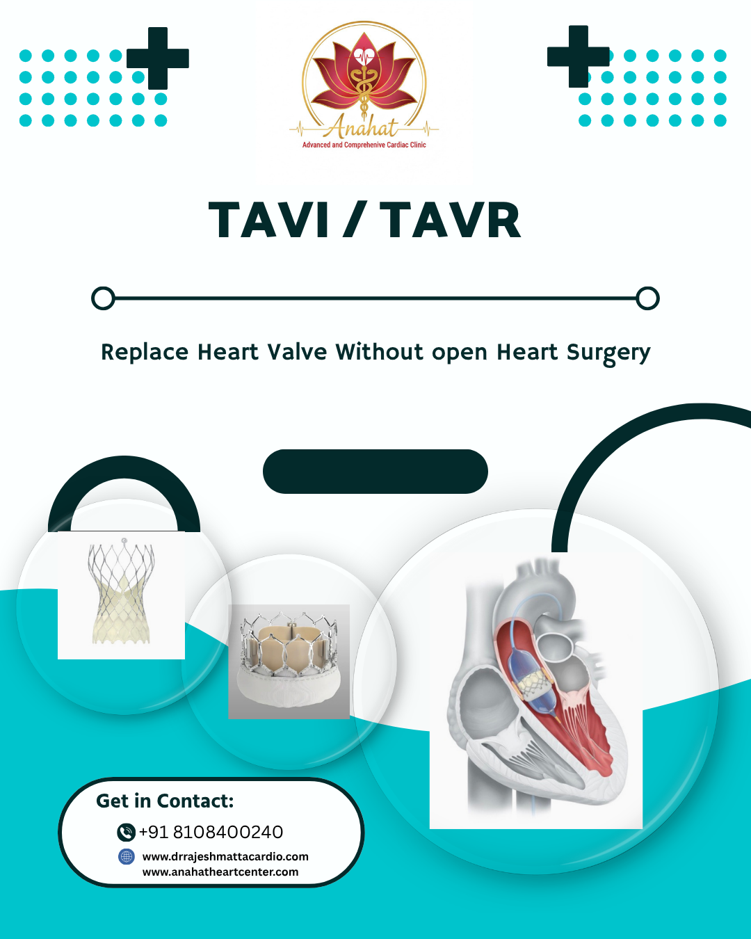 What Is Structural Heart Disease?