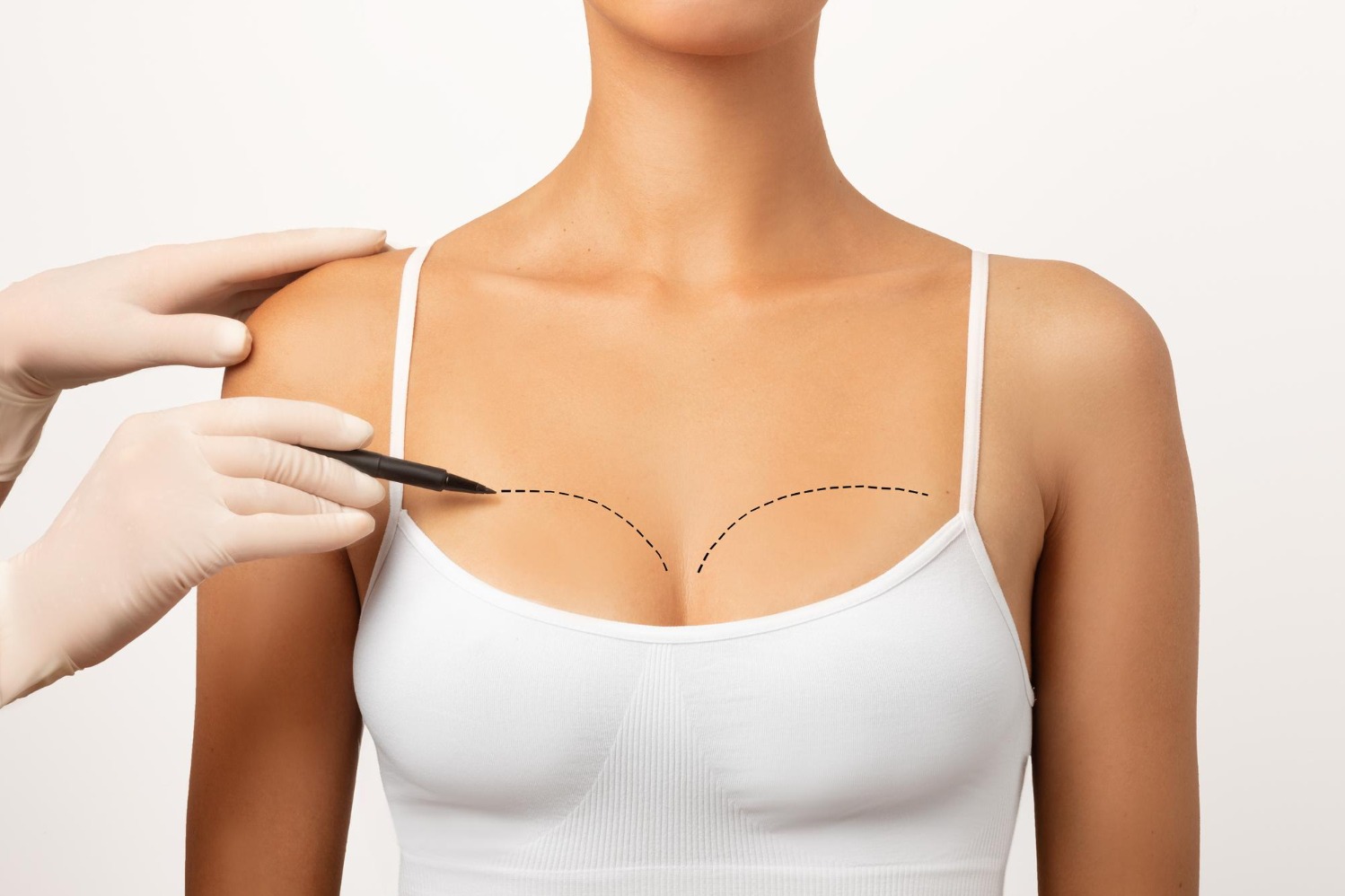 Choosing Breast Augmentation With the Right Questions Before Surgery