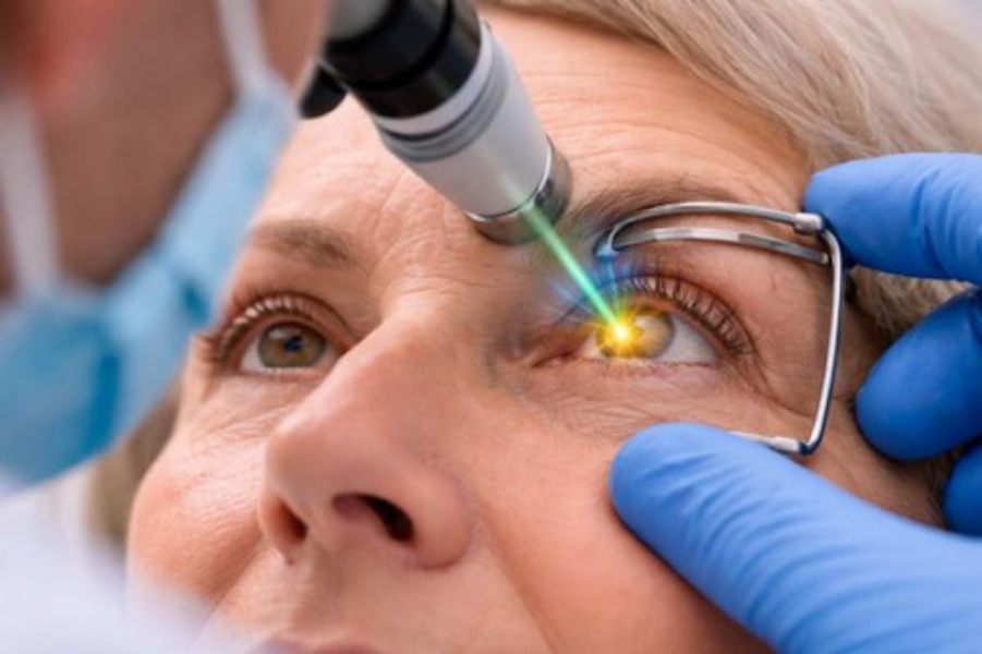When YAG Laser Treatment May Be Recommended After Cataract Surgery