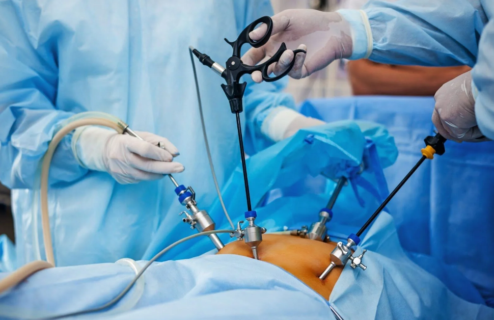 When Advanced Laparoscopic Surgery Pune Is Used in Gynaecological Care