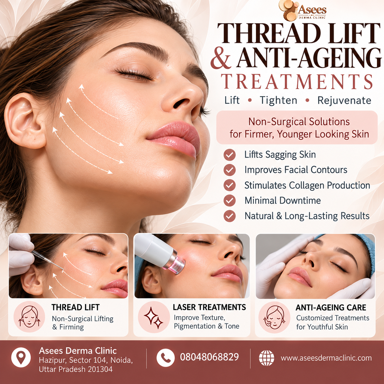 Thread Lift Treatment in Noida Sector 104