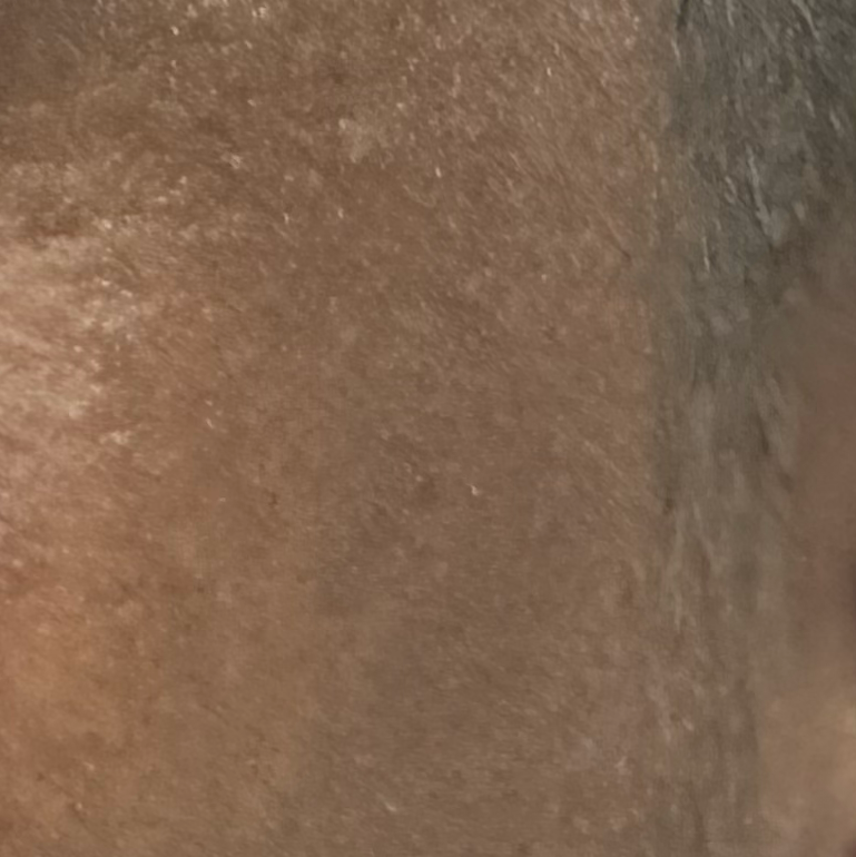 Vibha skin