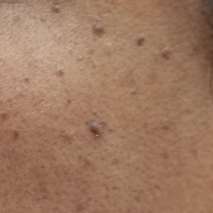 Vibha skin