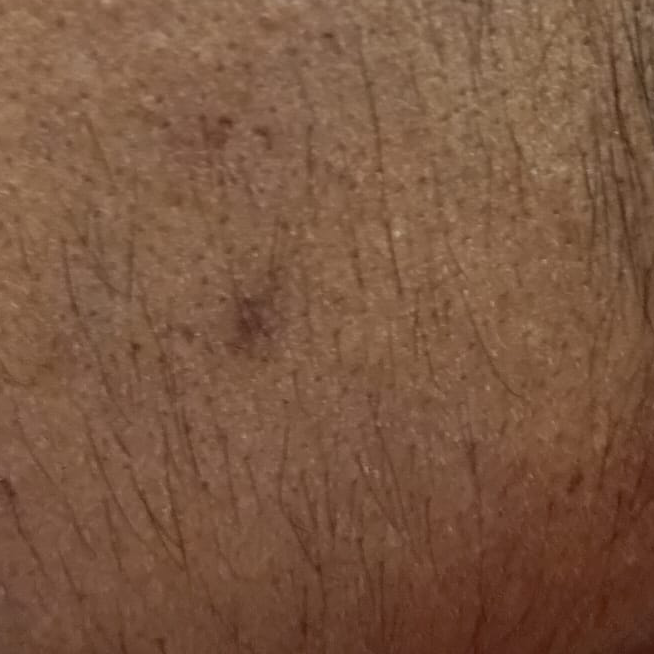 Vibha skin