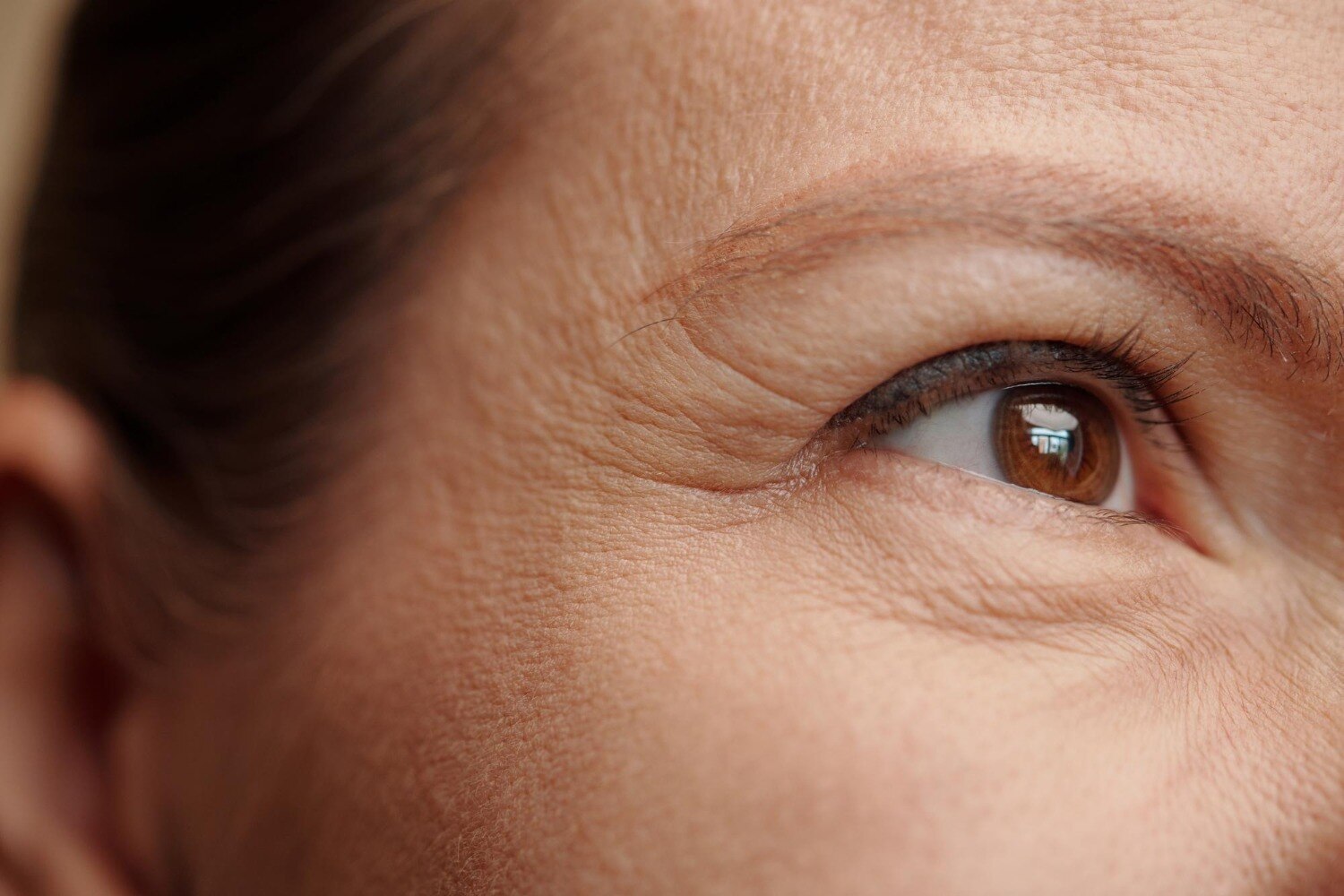 Wrinkle Treatment Options for Different Types of Facial Lines